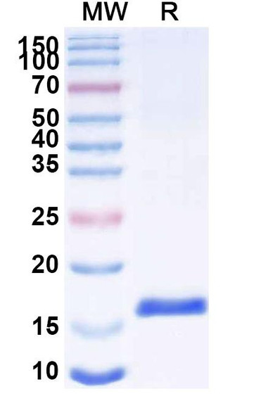 Anti-SARS-CoV-2 S Protein Recombinant Nanobody (SAA1066) - SDS-PAGE