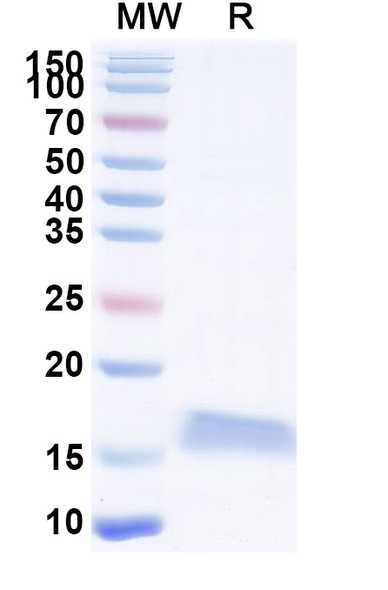 Anti-SARS-CoV-2 S Protein Recombinant Nanobody (SAA1070) - SDS-PAGE