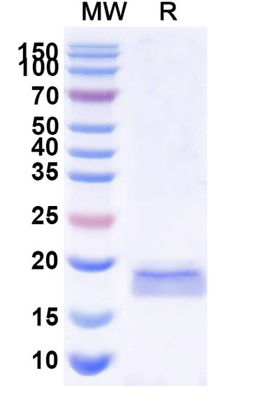 Anti-SARS-CoV-2 S Protein Recombinant Nanobody (SAA1071) - SDS-PAGE