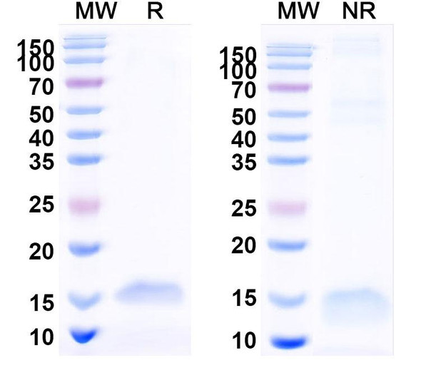 Anti-SARS-CoV-2 S Protein Recombinant Nanobody (SAA1072) - SDS-PAGE