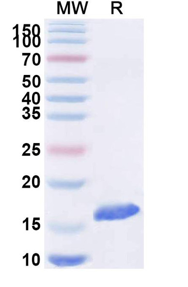 Anti-SARS-CoV-2 S Protein Recombinant Nanobody (SAA1074) - SDS-PAGE