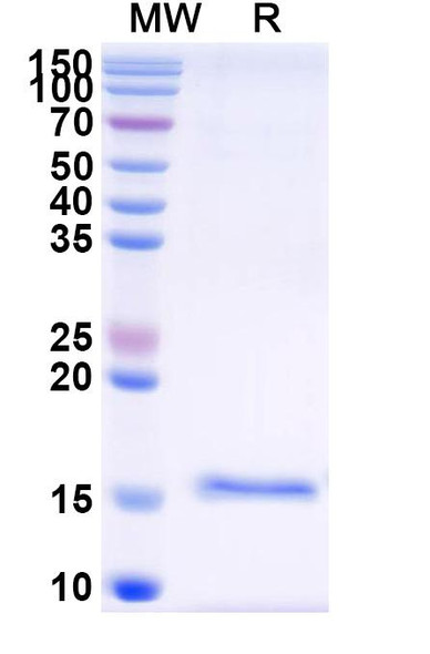 Anti-SARS-CoV-2 S Protein Recombinant Nanobody (SAA1075) - SDS-PAGE