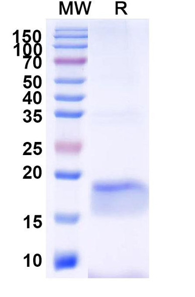 Anti-SARS-CoV-2 S Protein Recombinant Nanobody (SAA1077) - SDS-PAGE