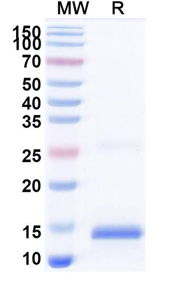 Anti-SARS-CoV-2 S Protein Recombinant Nanobody (SAA1084) - SDS-PAGE