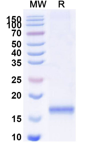 Anti-SARS-CoV-2 S Protein Recombinant Nanobody (SAA1091) - SDS-PAGE