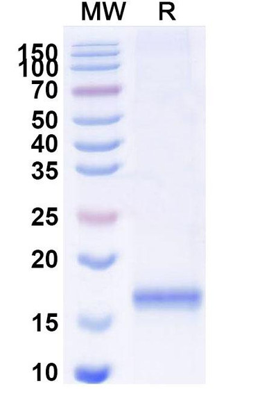 Anti-SARS-CoV-2 S Protein Recombinant Nanobody (SAA1091) - SDS-PAGE