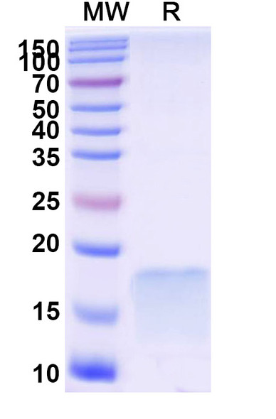 Anti-SARS-CoV-2 S Protein Recombinant Nanobody (SAA1092) - SDS-PAGE