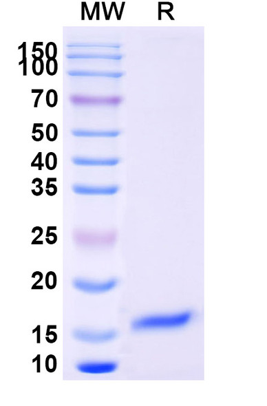 Anti-SARS-CoV-2 S Protein Recombinant Nanobody (SAA1094) - SDS-PAGE