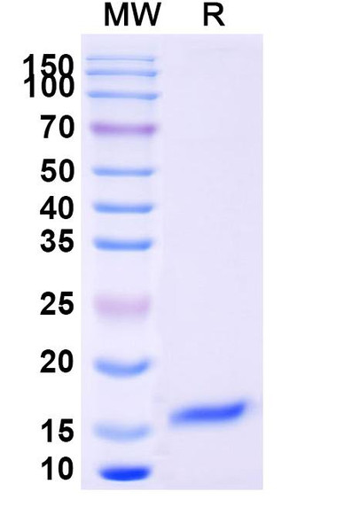 Anti-SARS-CoV-2 S Protein Recombinant Nanobody (SAA1094) - SDS-PAGE