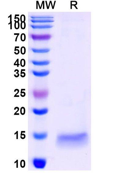 Anti-SARS-CoV-2 S Protein Recombinant Nanobody (SAA1096) - SDS-PAGE