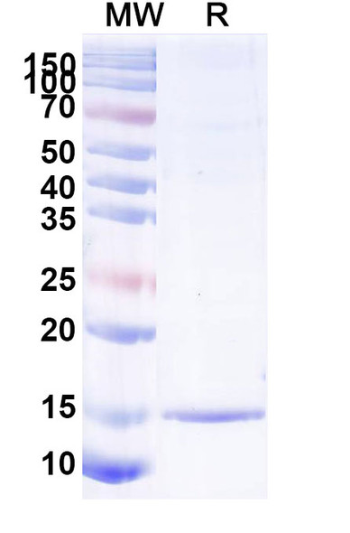 Anti-SARS-CoV-2 S Protein Recombinant Nanobody (SAA1100) - SDS-PAGE