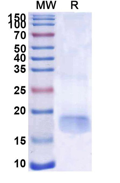 Anti-SARS-CoV-2 S Protein Recombinant Nanobody (SAA1101) - SDS-PAGE