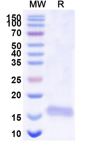 Anti-SARS-CoV-2 S Protein Recombinant Nanobody (SAA1108) - SDS-PAGE