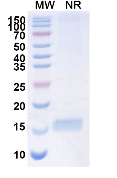 Anti-SARS-CoV-2 S Protein Recombinant Nanobody (SAA1111) - SDS-PAGE