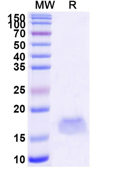 Anti-HRSV F/Fusion glycoprotein F0 Recombinant Nanobody (SAA1036) - SDS-PAGE