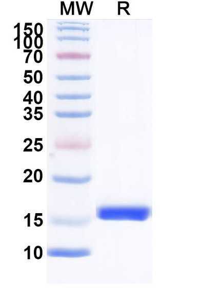 Anti-HIV1 Surface protein gp120 Recombinant Nanobody (SAA0912) - SDS-PAGE