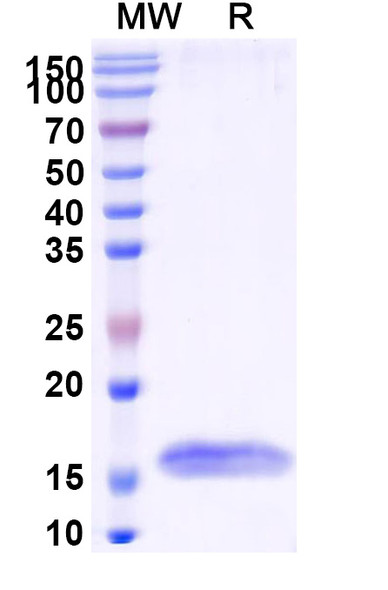 Anti-HIV1 Surface protein gp120 Recombinant Nanobody (SAA0882) - SDS-PAGE