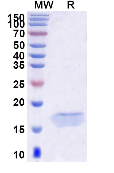 Anti-HIV1 Surface protein gp120 Recombinant Nanobody (SAA0894) - SDS-PAGE