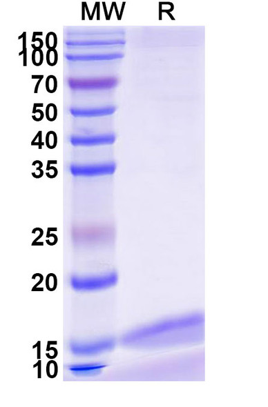 Anti-Zaire ebolavirus/ZEBOV GP/GP1, 2 Recombinant Nanobody (SAA1248) - SDS-PAGE