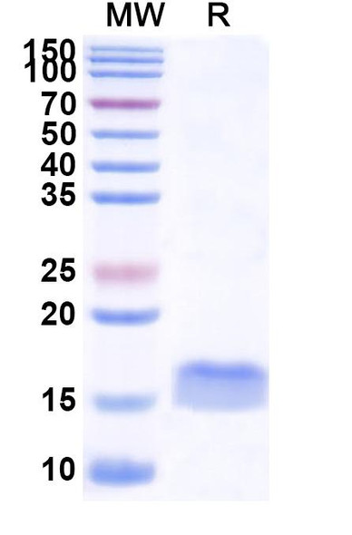 Anti-Human papillomavirus type 16 E7/Protein E7 Recombinant Nanobody (SAA1326) - SDS-PAGE