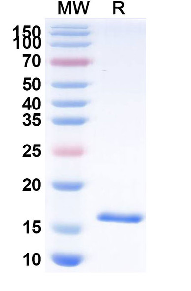 Anti-HCMV/HHV5 HHRF3/US28 Recombinant Nanobody (SAA1150) - SDS-PAGE