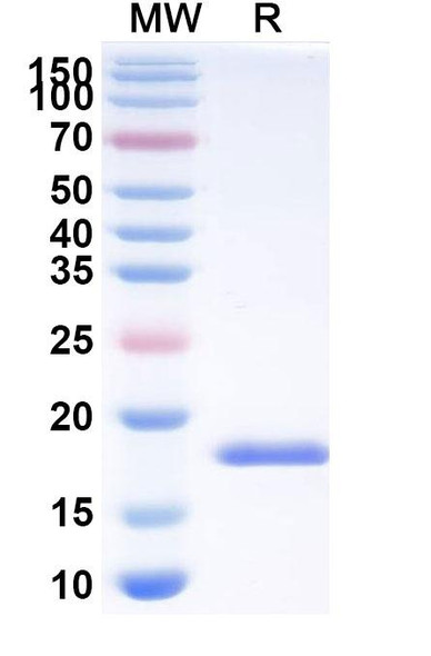 Anti-HCMV/HHV5 HHRF3/US28 Recombinant Nanobody (SAA0899) - SDS-PAGE