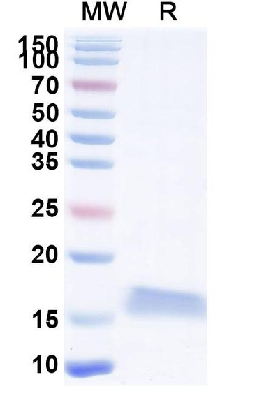 Anti-Clostridium botulinum botA/BOTOX Recombinant Nanobody (SAA0924) - SDS-PAGE