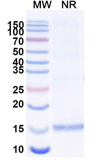 Anti-Clostridium botulinum botA/BOTOX Recombinant Nanobody (SAA0928) - SDS-PAGE