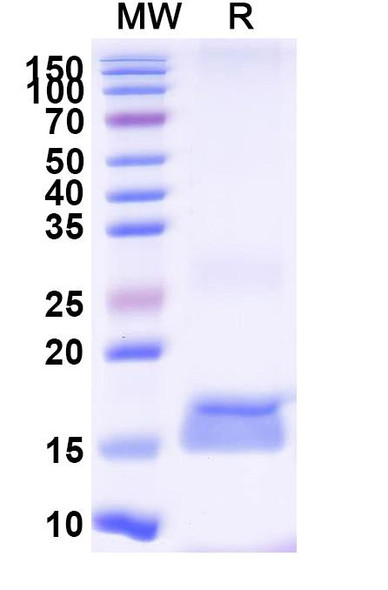 Anti-Clostridium botulinum botA/BOTOX Recombinant Nanobody (SAA0930) - SDS-PAGE