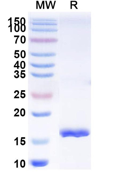 Anti-Clostridium botulinum botA/BOTOX Recombinant Nanobody (SAA0932) - SDS-PAGE