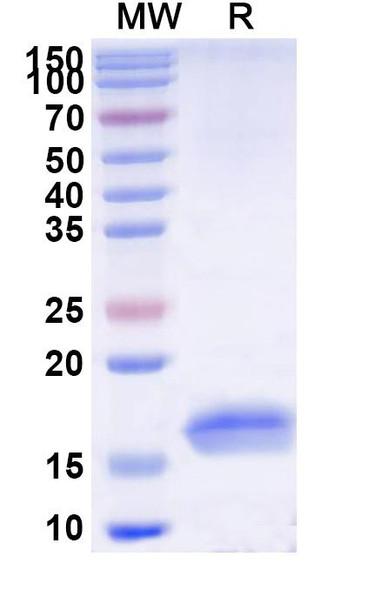Anti-Clostridium botulinum botA/BOTOX Recombinant Nanobody (SAA0934) - SDS-PAGE
