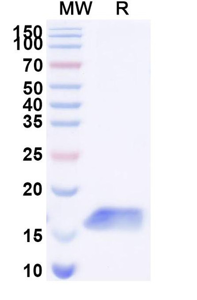 Anti-Clostridium botulinum botA/BOTOX Recombinant Nanobody (SAA0936) - SDS-PAGE
