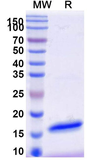 Anti-Clostridium botulinum botA/BOTOX Recombinant Nanobody (SAA0937) - SDS-PAGE