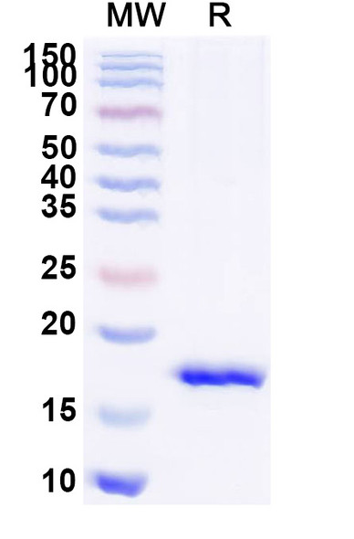 Anti-Staphylococcus aureus entB/SEB Recombinant Nanobody (SAA1238) - SDS-PAGE