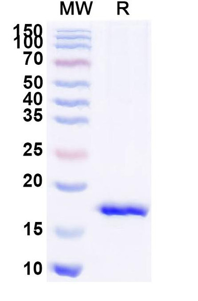 Anti-Staphylococcus aureus entB/SEB Recombinant Nanobody (SAA1238) - SDS-PAGE