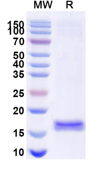 Anti-Porphyromonas gingivalis porM Recombinant Nanobody (SAA1181) - SDS-PAGE