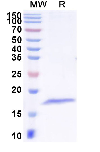Anti-Clostridium tetani tetX/Tetanus toxin Recombinant Nanobody (SAA1236) - SDS-PAGE