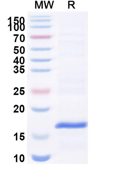 Anti-Vibrio cholerae serotype O1 higB-2 Recombinant Nanobody (SAA1035) - SDS-PAGE