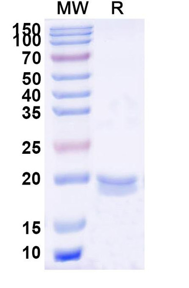 Anti-Clostridium botulinum BoNT/B Recombinant Nanobody (SAA0938) - SDS-PAGE