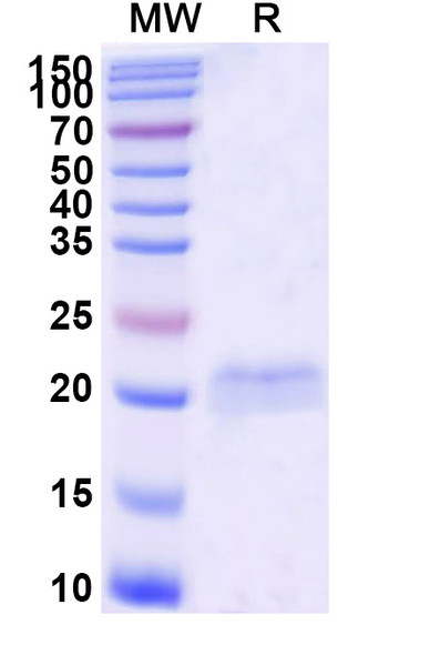 Anti-Castor bean Ricin Recombinant Nanobody (SAA0878) - SDS-PAGE