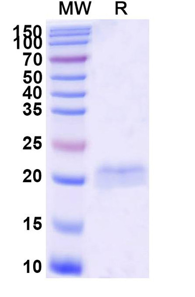 Anti-Castor bean Ricin Recombinant Nanobody (SAA0878) - SDS-PAGE