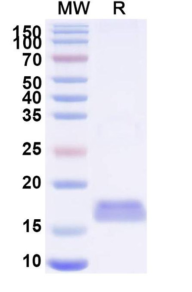 Anti-Castor bean Ricin Recombinant Nanobody (SAA0985) - SDS-PAGE