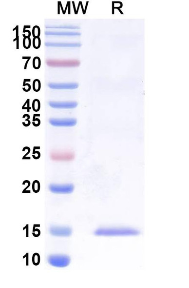 Anti-Castor bean Ricin Recombinant Nanobody (SAA0988) - SDS-PAGE