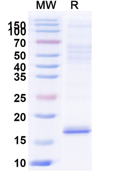 Anti-Castor bean Ricin Recombinant Nanobody (SAA0991) - SDS-PAGE