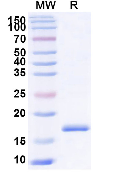 Anti-Castor bean Ricin Recombinant Nanobody (SAA1000) - SDS-PAGE