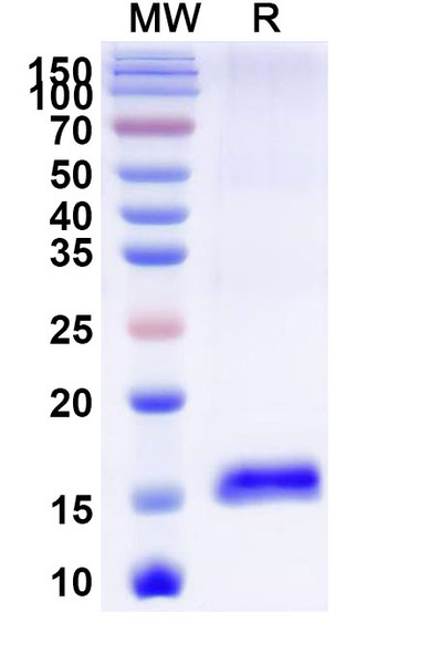 Anti-Castor bean Ricin Recombinant Nanobody (SAA1001) - SDS-PAGE