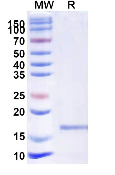 Anti-Castor bean Ricin Recombinant Nanobody (SAA1088) - SDS-PAGE