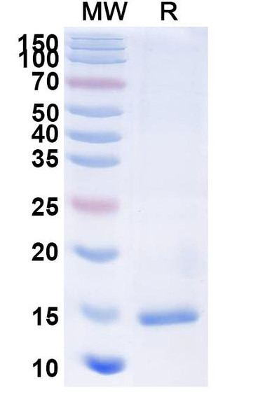 Anti-Castor bean Ricin Recombinant Nanobody (SAA1097) - SDS-PAGE