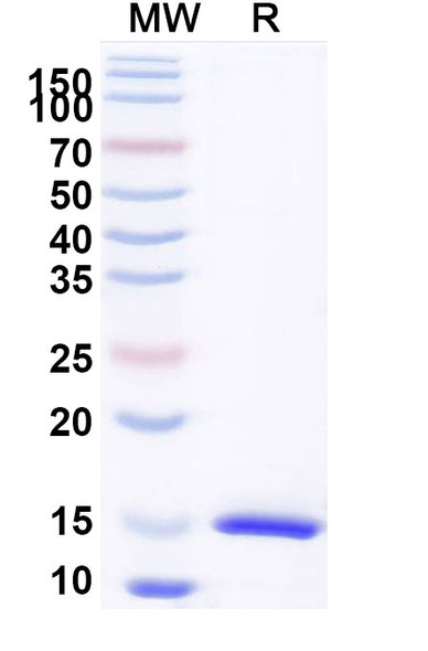 Anti-Castor bean Ricin Recombinant Nanobody (SAA1142) - SDS-PAGE