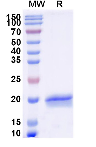 Anti-Castor bean Ricin Recombinant Nanobody (SAA1143) - SDS-PAGE